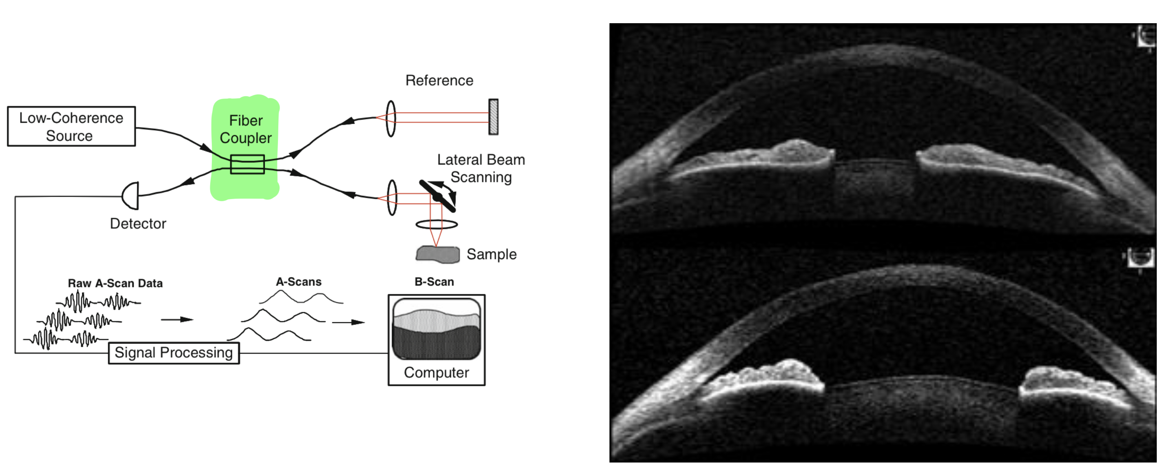 Optical Coherence Tomography setup (without FPI here) and OCT scan of the eye pupil.